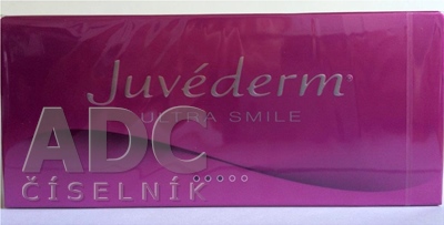 Juvéderm ULTRA SMILE